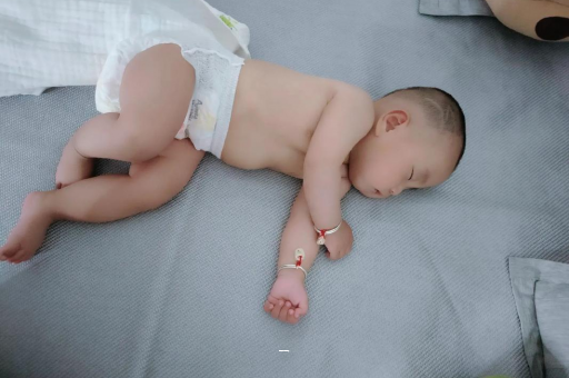 衡东宝宝脸上有白色斑块